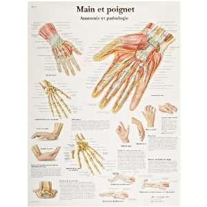   Wrist Anatomy and Pathology Chart, French), Poster Size 20 Width x 26