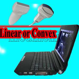 Digital Laptop Ultrasound Scanner Convex or Linear 900F  