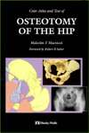   The Hip, (0723416818), Malcolm F. MacNicol, Textbooks   