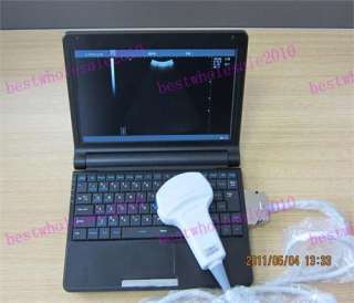   Digital Laptop Ultrasound Machine / Scanner w Convex Probe RUS 9000F