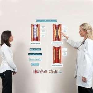  Angioplasty Series Labeled Sticky Anatomy Wall Chart 
