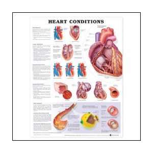  Heart Conditions Anatomical Chart 20 X 26 Laminated 