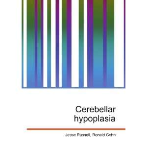  Cerebellar hypoplasia Ronald Cohn Jesse Russell Books