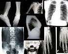 lot 7 real human x rays xray medical image images